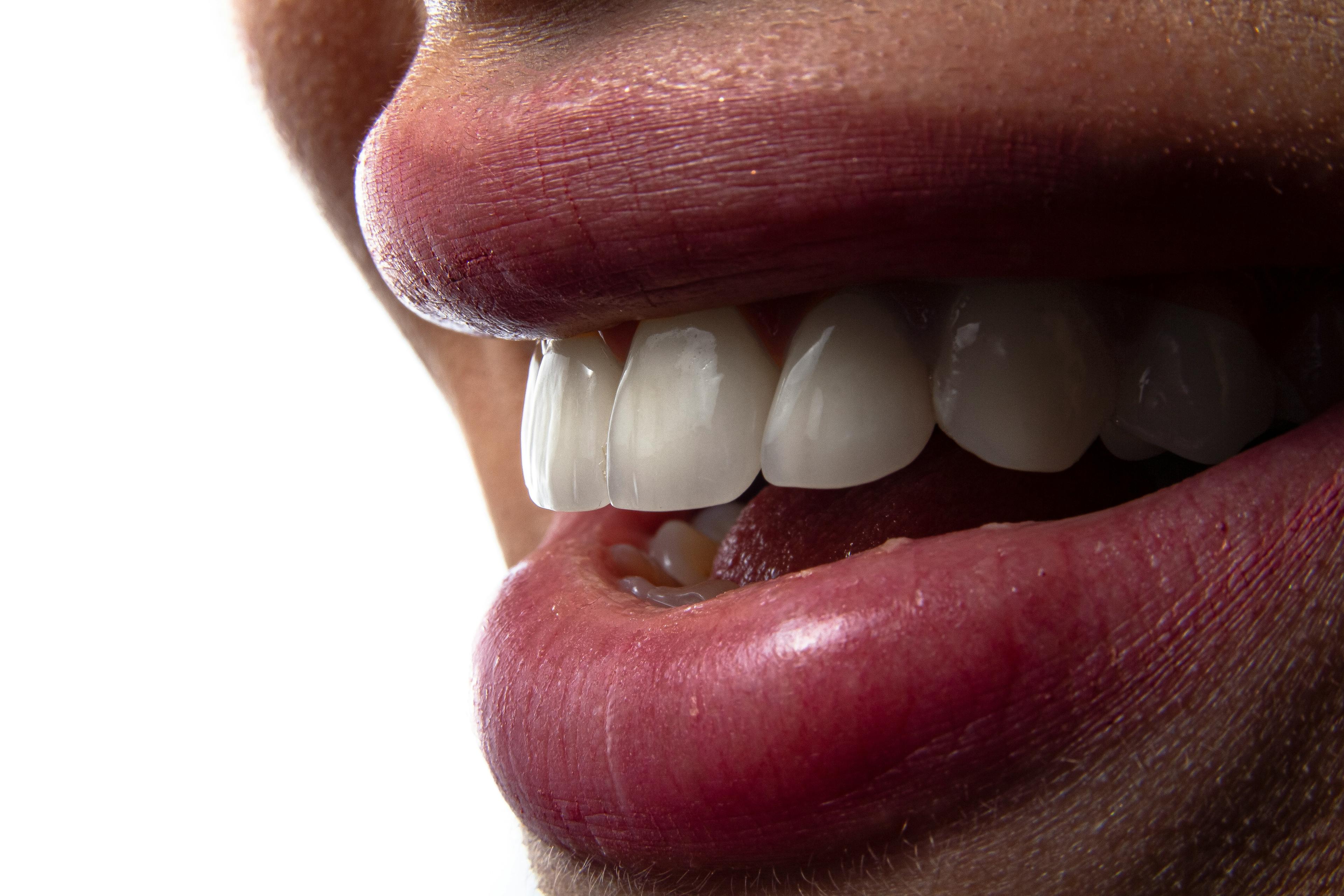 Smile transformation 2